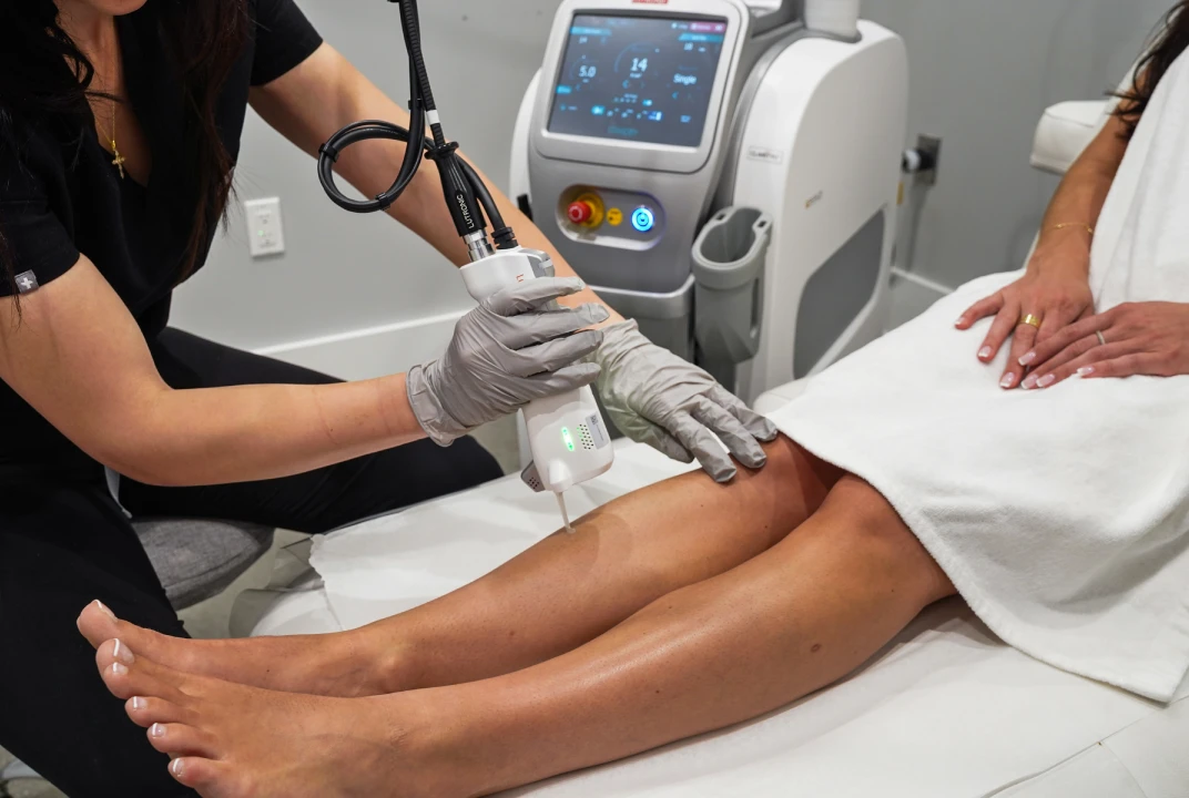 Image of a laser hair removal session at Liv Aesthetics LLC in New Fairfield, CT. A technician uses a handheld laser device on a client’s leg, highlighting a precise, professional treatment designed for smooth, long-lasting hair reduction.